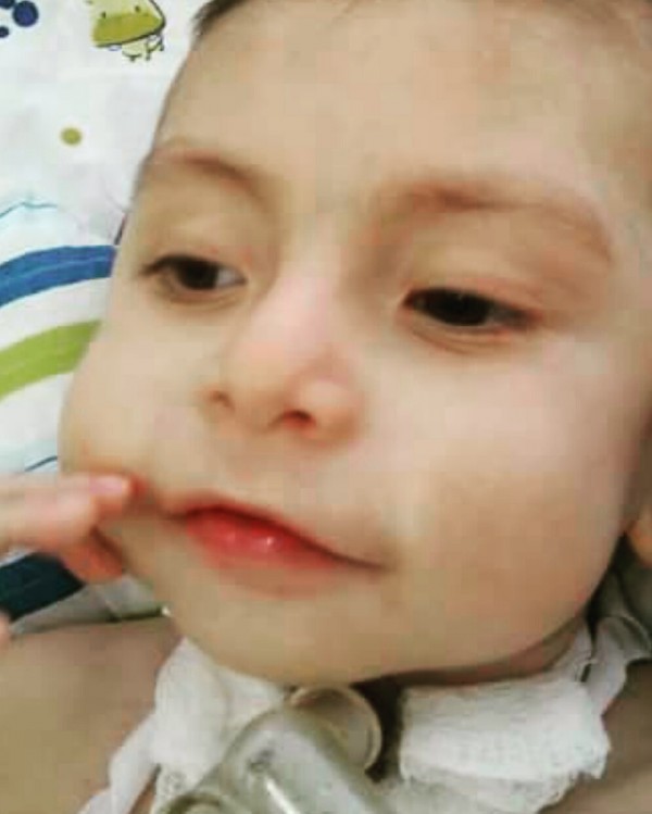 Matheus, dois anos, espera aparelho pára deixar hospital após dez meses