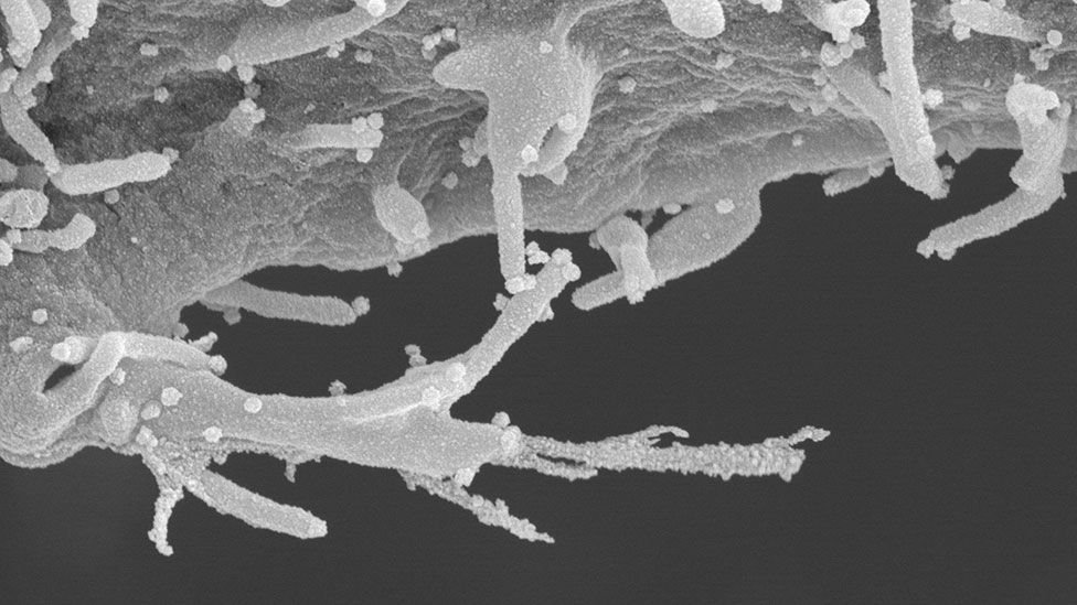 Imagem microscópica em preto e branco mostra filamentos e bolinhas de vírus