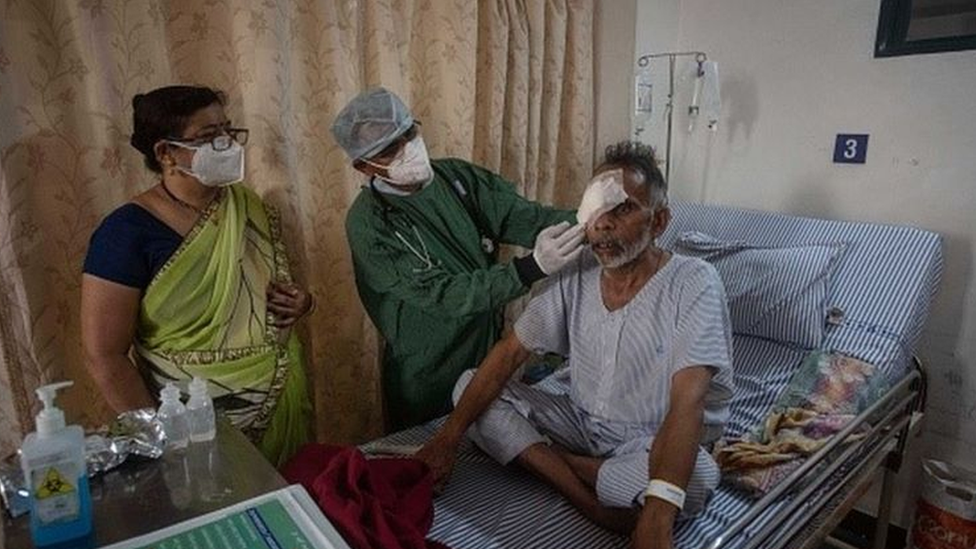 Paciente com olho comprometido por infecção fúngica