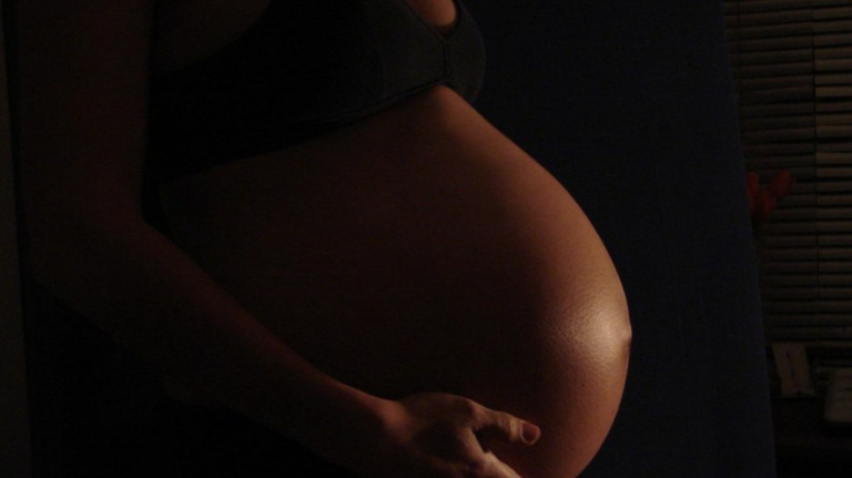 Médico repudia decisões que impediram aborto de grávida de siameses