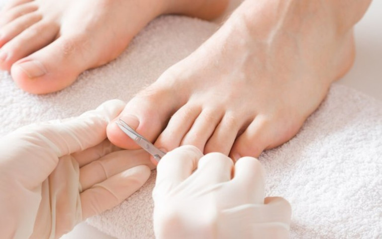 4 cuidados com as unhas de diabéticos