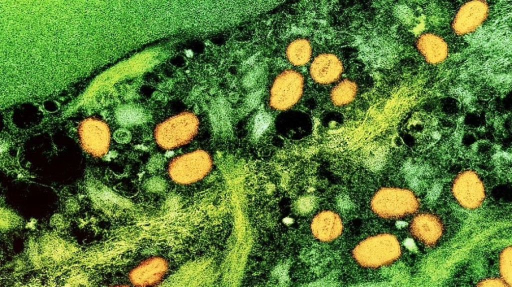 Especialistas alertam que Mpox ainda é problema de saúde pública
