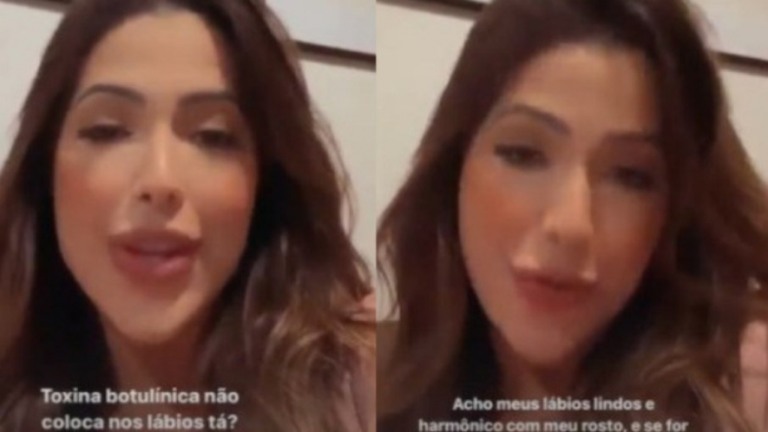 Ex- BBB Laís rebate críticas sobre preenchimento: 'Vou colocar mais'