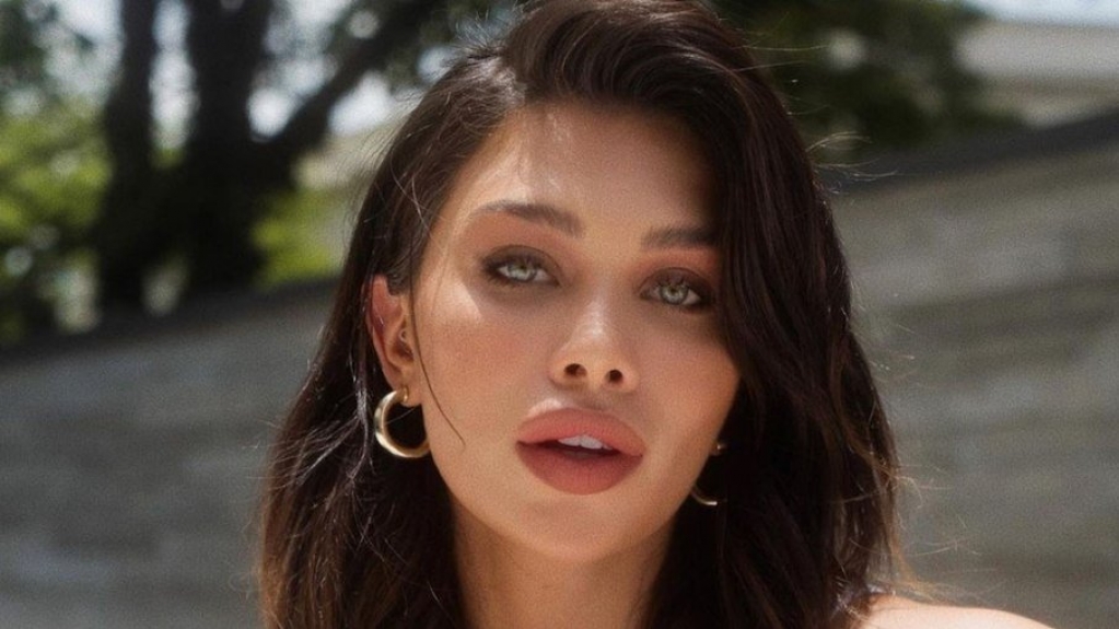 Flavia Pavanelli retira preenchimento labial e mostra resultado; veja Flavia Pavanelli retira preenchimento labial e mostra resultado; veja