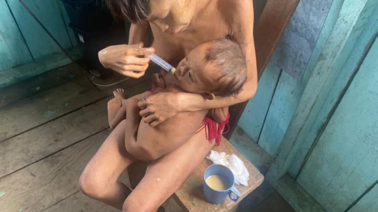 Hospital montando para atender yanomamis entra em funcionamento