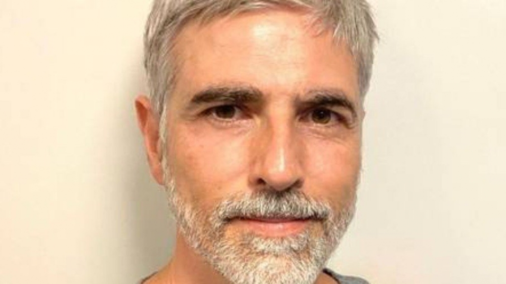 Reynaldo Gianecchini passa por procedimento estético Reynaldo Gianecchini passa por procedimento estético