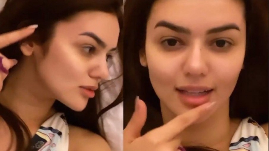 Ex-BBB Eslovênia mostra resultado de harmonização: ‘Estou um abuso’ Ex-BBB Eslovênia mostra resultado de harmonização: ‘Estou um abuso’