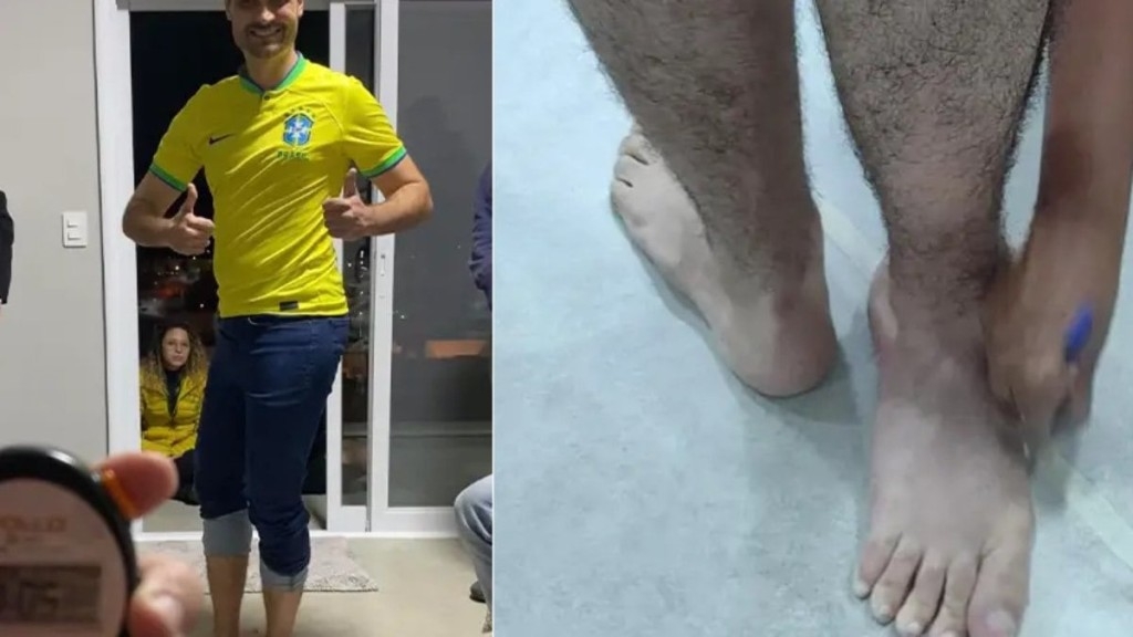 Reprodução Renato se tornou recordista