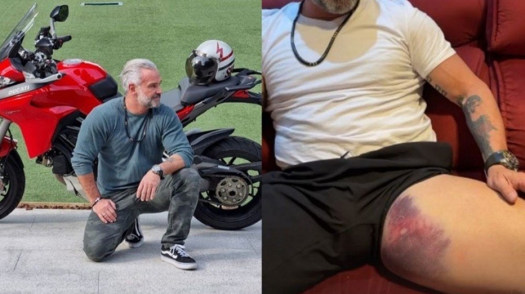 Mateus Carrieri sofre lesão grave na coxa: "Deu muito ruim"