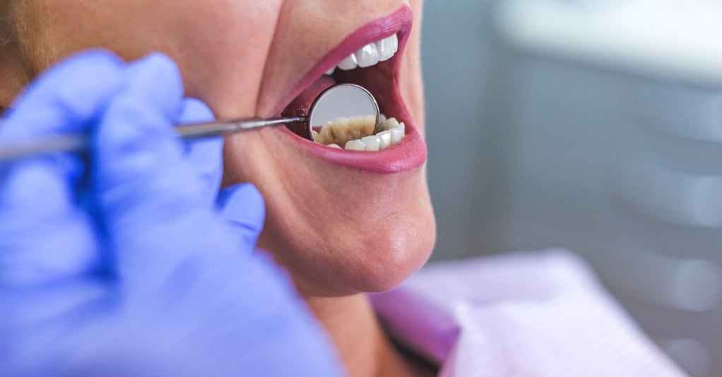 Maioria ignora riscos de infecções dentárias; conheça e veja como prevenir