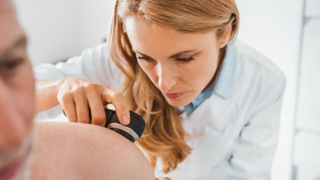 Redação EdiCase Autoexame é importante para identificar mudanças em pintas e melanomas