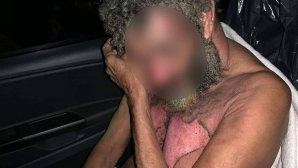 Homem em situação de rua tem corpo queimado enquanto dormia em Nova Iguaçu (RJ) Homem em situação de rua tem corpo queimado enquanto dormia em Nova Iguaçu (RJ)