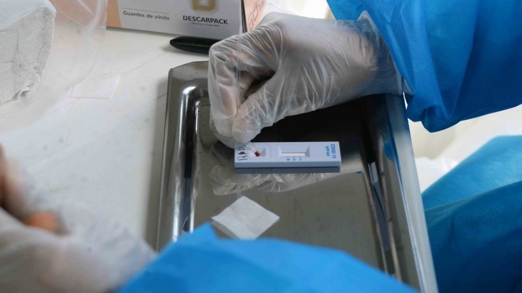 Anvisa adia decisão de liberação dos autotestes de Covid no Brasil