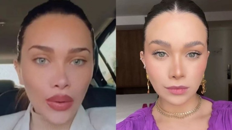 Flavia Pavanelli comenta retirada de preenchimento labial: "Mais leve"