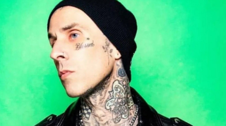 Travis Barker, baterista do Blink-182, foi internado com pancreatite