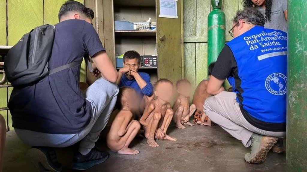 Desnutrição atinge mais de 50% das crianças Yanomami de até 5 anos