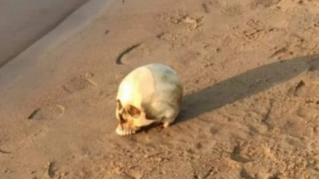 Crânio humano com dentes e aparelho ortodôntico é encontrado no interior do Acre