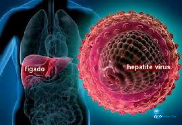 Saúde lança Censo On line para hepatite C