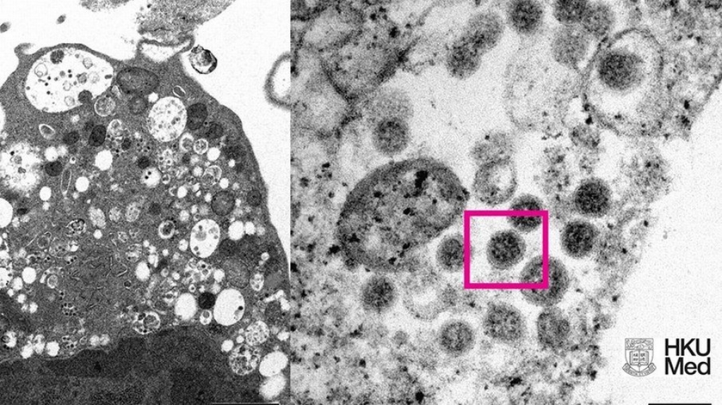 Ômicron: dados mostram que casos tendem a diminuir em dois meses Ômicron: dados mostram que casos tendem a diminuir em dois meses