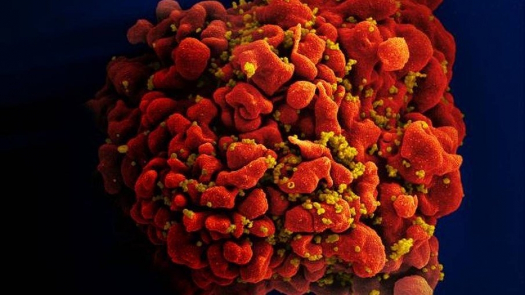 Injeção contra HIV com 90% de eficácia é aprovada por agência dos EUA