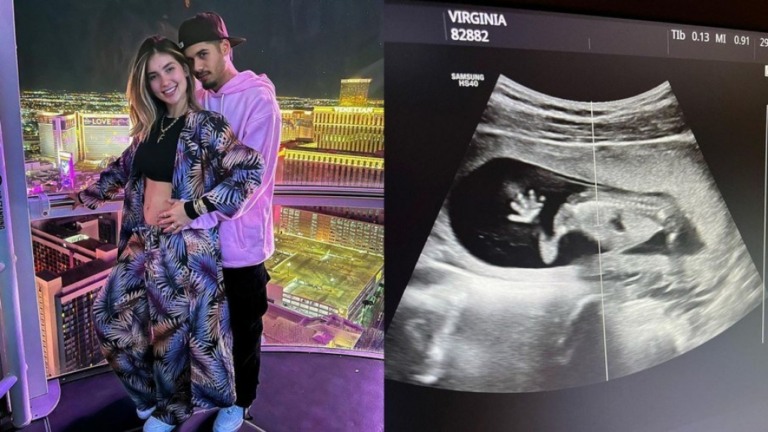 Virgínia Fonseca mostra ultrassom do filho com Zé Felipe: "Já te amo"