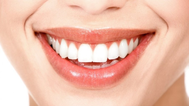 Clareamento dental allineari