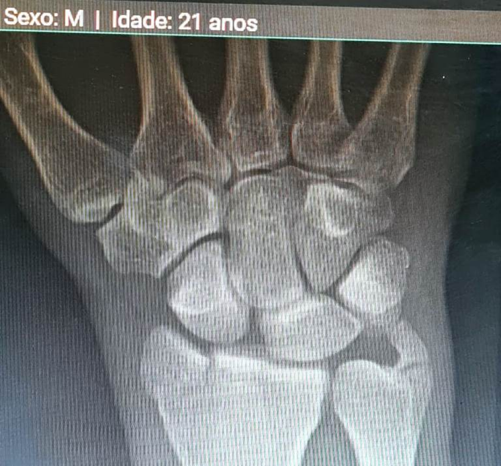 Justiça manda plano de saúde fazer cirurgia de urgência; um mês de espera