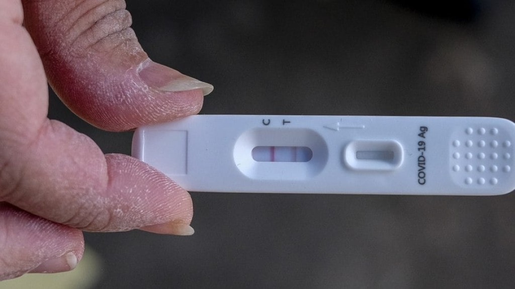 Covid: testes positivos em farmácias tiveram alta de 1001% em novembro