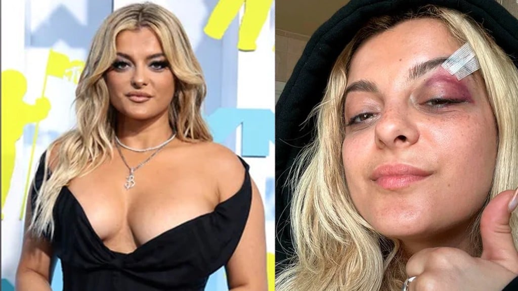 Bebe Rexha é atingida por celular no palco e tem ferimento no rosto: ‘Abandonou palco”