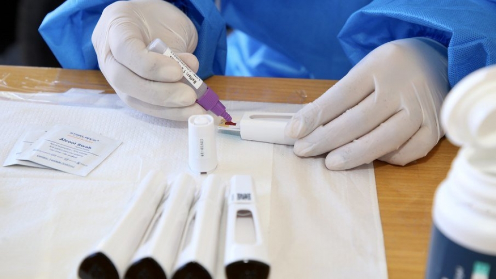 Covid-19: Brasil registra 168.495 casos em 24h