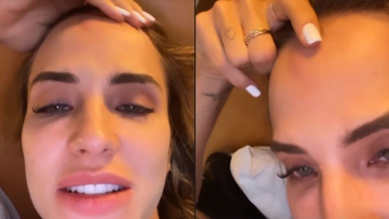 Após desfile na Sapucaí, Gabi Martins exibe hematoma na testa