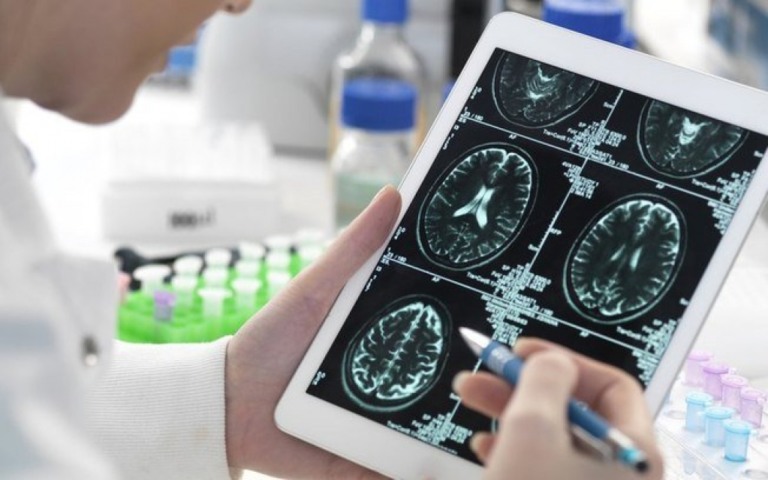 'Parece que perdi QI', diz neurologista que sofre com covid longa
