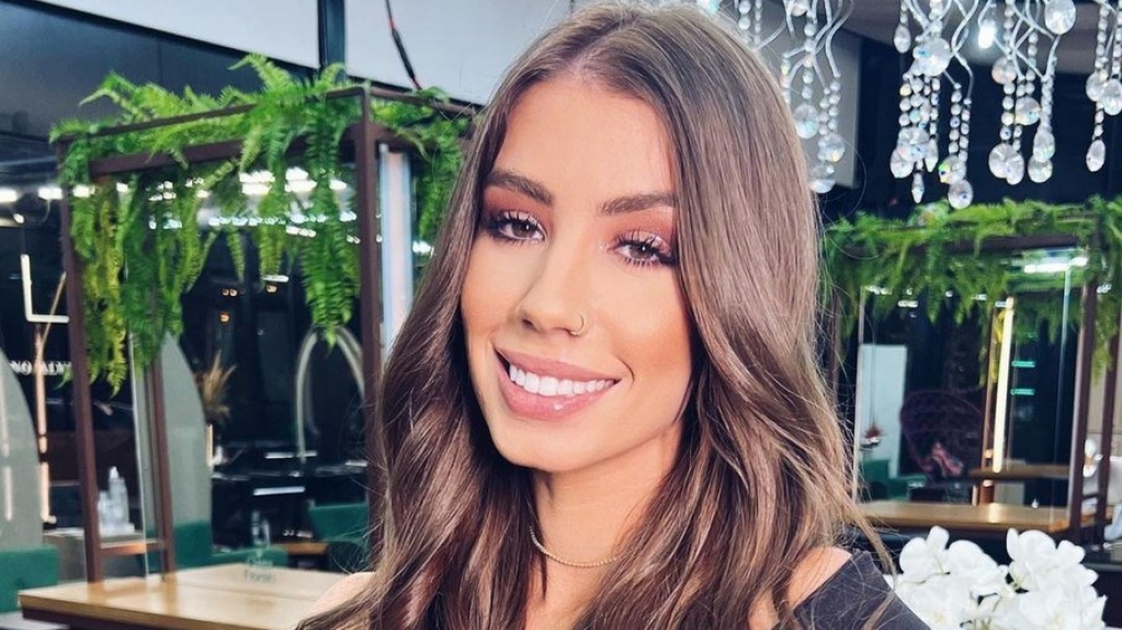 Maria Lina compartilha antes e depois de preenchimento labial; veja Maria Lina compartilha antes e depois de preenchimento labial; veja