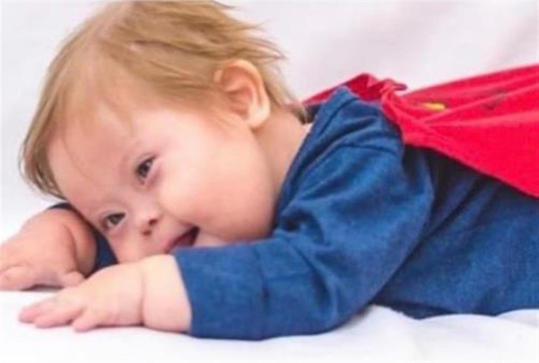 Morre em Bauru Super Chico, menino que venceu Covid e inspirou