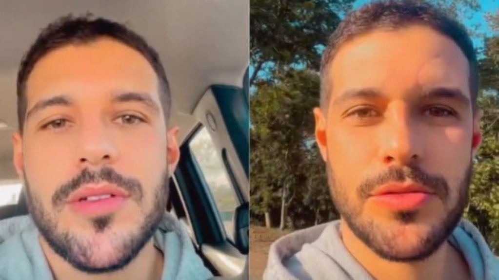 Rodrigo Mussi diz que perdeu paladar e olfato após acidente Rodrigo Mussi diz que perdeu paladar e olfato após acidente