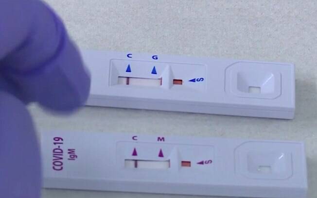 Teste rápido para Covid-19 em farmácia em Minas Gerais