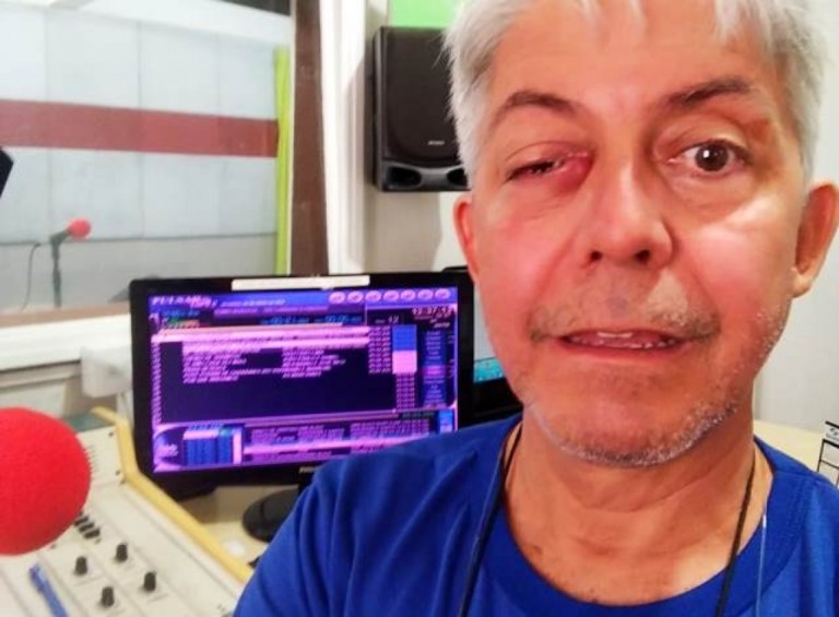 Radialista ganha corrente de apoio em Marília para cirurgia de alto custo