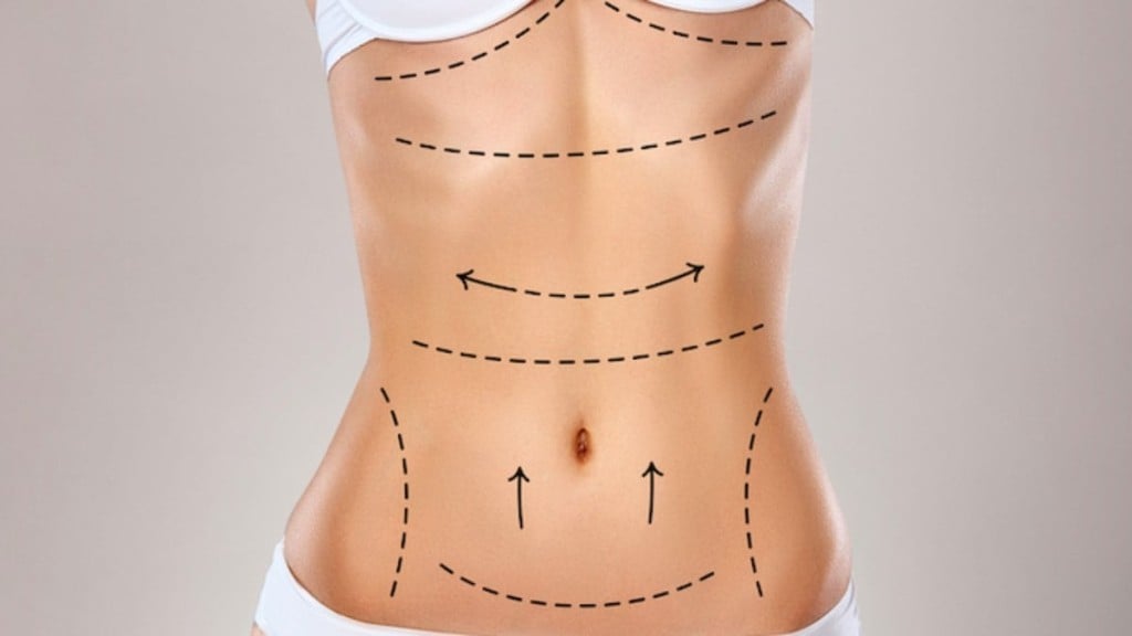 Divulgação Lipoaspiração: o que é HD, LAD e uGraft?