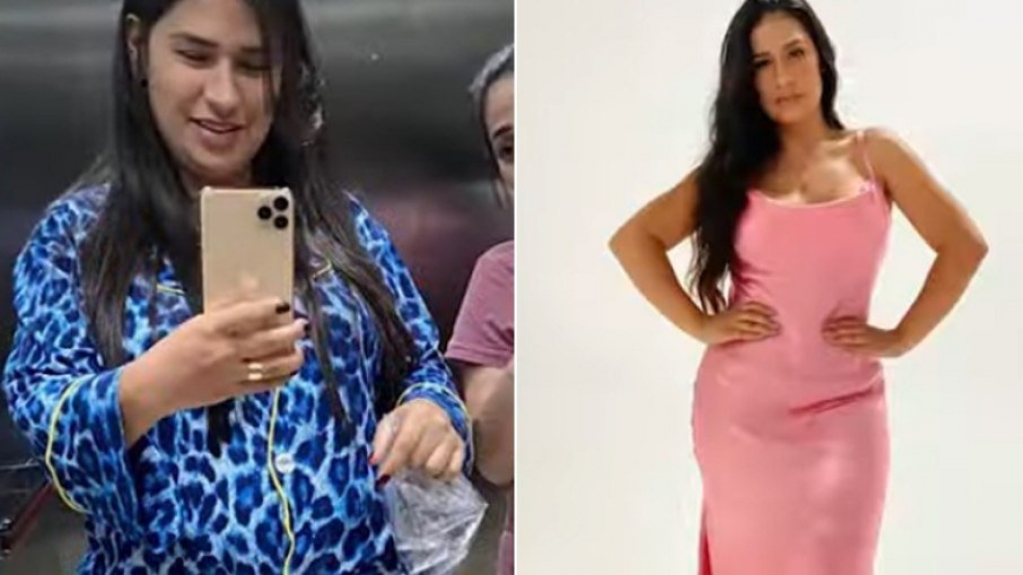 Simone mostra antes e depois de emagrecer: 'Hoje tenho vida'