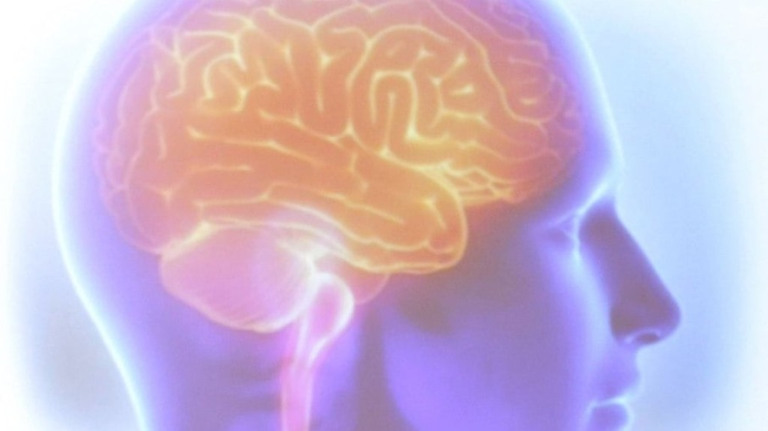 Droga retarda avanço do Alzheimer; porém tem efeito colateral de risco