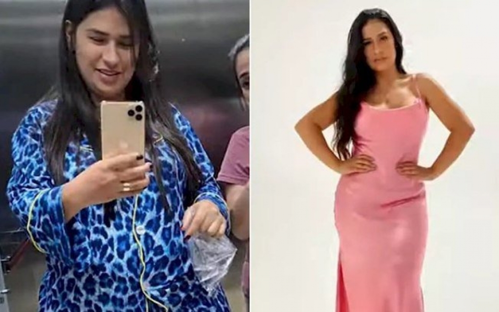 Simone mostra antes e depois após perder 25kg