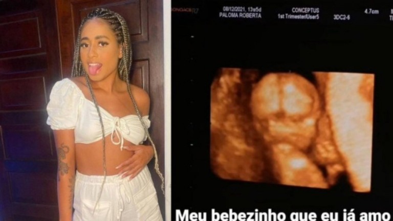 MC Loma se emociona ao fazer ultrassom: "Chorei tanto"