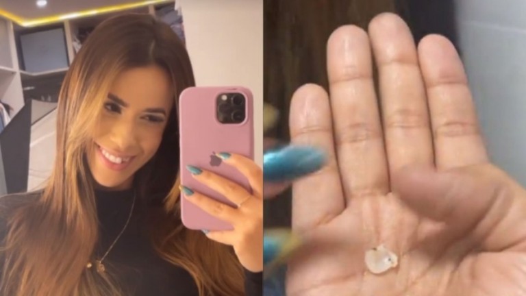 Larissa Tomásia perde dente em churrasco com outros ex-BBBs