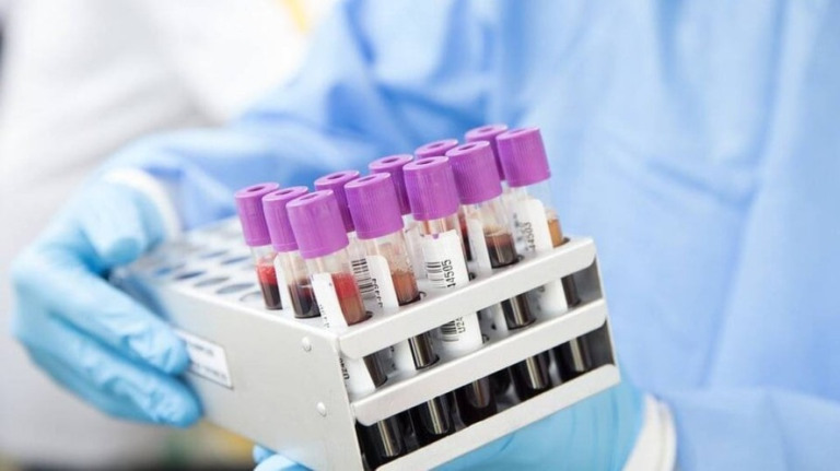 Alzheimer: Japão autoriza exame de sangue para detectar doença