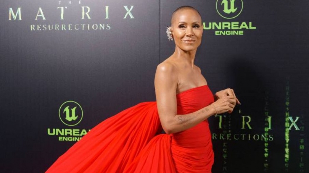 Entenda a doença de Jada Pinkett Smith que provoca queda de cabelo Entenda a doença de Jada Pinkett Smith que provoca queda de cabelo