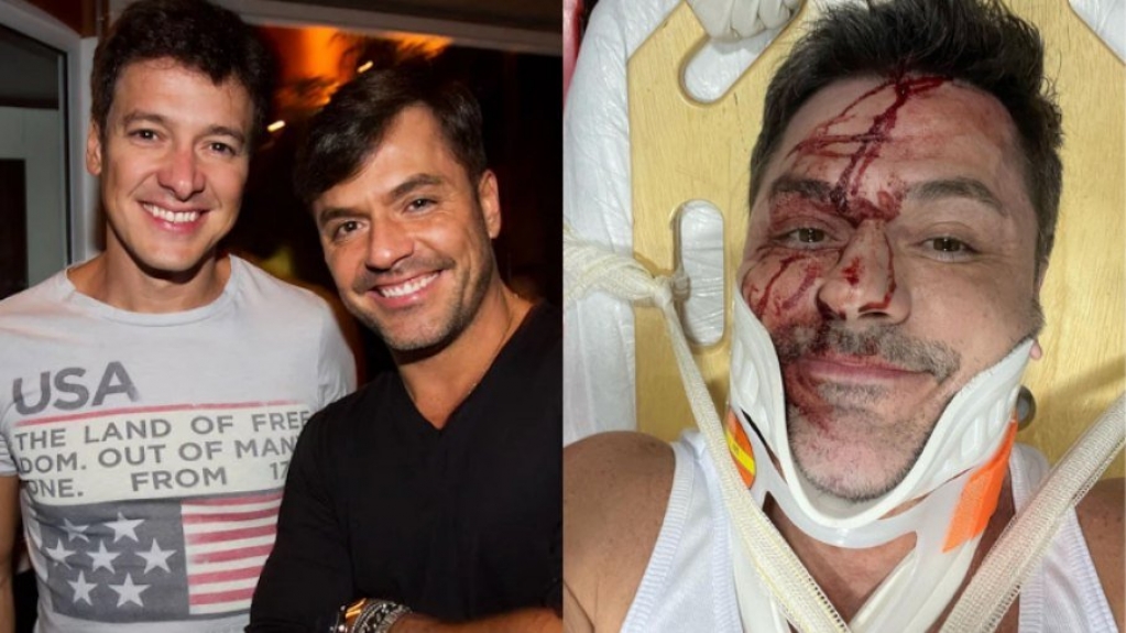 Irmão de Rodrigo Faro se envolve em acidente de carro e posta fotos machucado Irmão de Rodrigo Faro se envolve em acidente de carro e posta fotos machucado