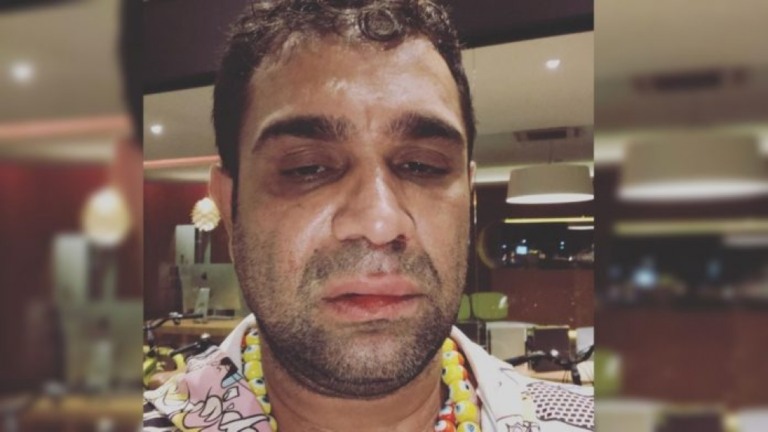 Humorista Evandro Santo, agredido em Marília, pede indenização de R$ 60 mil