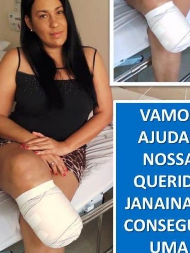 Campanha mobiliza amigos e familiares para dar prótese a mulher em Marília