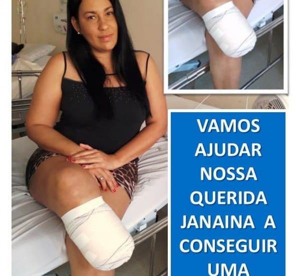 Campanha mobiliza amigos e familiares para dar prótese a mulher em Marília Campanha mobiliza amigos e familiares para dar prótese a mulher em Marília