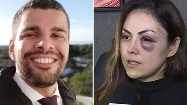 Procurador que espancou chefe tem esquizofrenia, aponta laudo